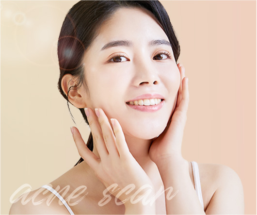 여드름 자국 & 흉터